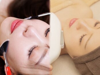 ベル 田原本町店(Belle)の写真/都度払いOK◎憧れの韓国女優肌へ【ララピール＋ピコホワイト★￥7700】韓国肌管理！くすみ解消＆透明感UP