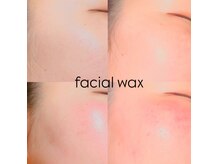 ゴリラアイブロウ 大通店の雰囲気（ワックス脱毛でお顔を整え清潔感up☆）