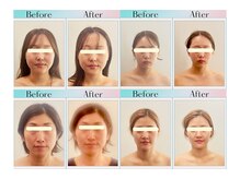 天空の手もみの雰囲気（清潔感のある店内でゆったり時間☆/小顔矯正/リンパマッサージ）