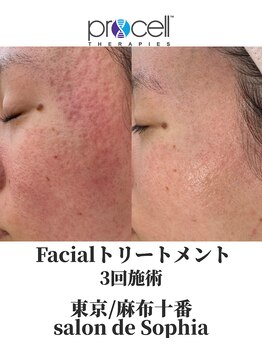 サロンドソフィア 麻布十番(salon de Sophia)/プロセルセラピーズフェイシャル