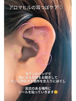 アロマヒル(ARO-MAHIR)/目立たない耳つぼシールも◎