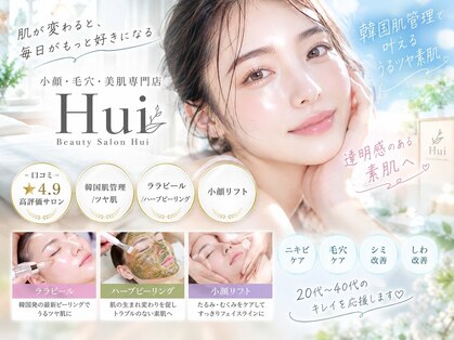 フイ(Hui)の写真