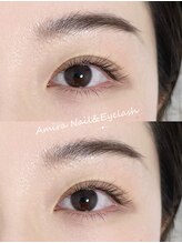 アミーラ(Amira)/フラットラッシュ