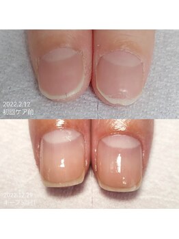 エヌプラス(Nplus)/育成３ヶ月コース→キープコース