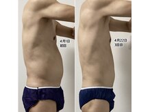 コア(CORE)/メンズ痩身エステもオススメ