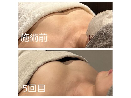 ドゥブレジャンティ(doubler gentil)の写真