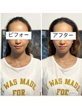 リモド(Rimodo509)/小顔矯正（ヘッドスパ