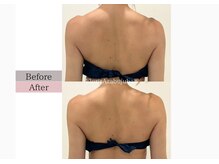 フロリール アザブジュウバン(FlorirAzabujuban)/痩身/肩こり/天使の羽