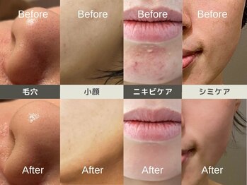 ルディラ 上野店/ルディラ医療提携エステ