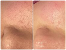 ソルエユニーク(Le seul et unique)