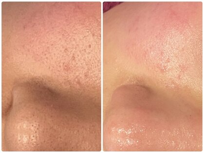 ソルエユニーク(Le seul et unique)の写真