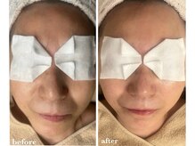 サロン ド ラム/【PDTコース】3回目