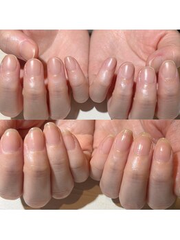 アティックネイルアトリエ(attic nail atelier)/自爪育成
