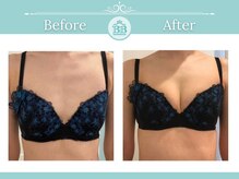 美人バスト 赤羽店/【バストアップ★育乳】症例