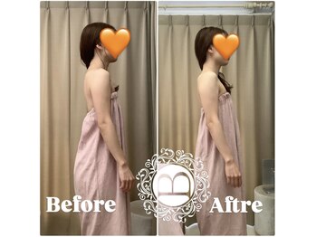 ミラクルバスト 銀座店の写真/[初めてのバストアップなら全国350店舗本店ミラクルバスト銀座♪]洗礼されたプロの手技で一度で効果を体感!