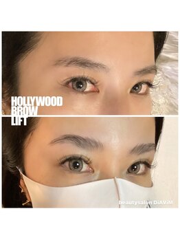 ディアビム(DiAViM)/＊ハリウッドブロウリフト＊
