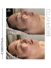 サロン ド ブラン アオヤマ(Salon de BLANC AOYAMA)/ビオフィート×ソノケア