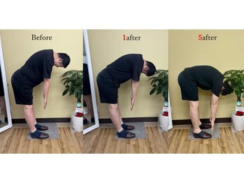 アプロ(APLO)/自律神経調整+姿勢矯正