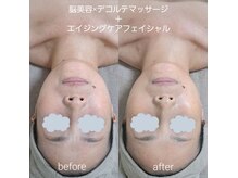 ネマウム(nemaum)/エイジングケアエステ