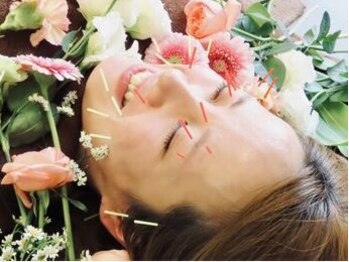 フィリア(PHILIA)の写真/最近綺麗になったあの人の秘密は「美容鍼灸」でした☆結果重視の《ハリウッドスタイル美容鍼¥8,800》