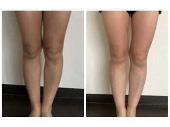 ヨサパーク ピュアン(YOSA PARK)/スラリ美脚に