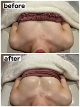 マイントゥー(mine too)/