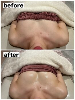 マイントゥー(mine too)/