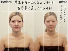 リストアハート(Restore Heart)