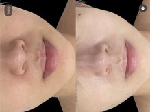 ルビー(Ruby)/ノーファンデアンプル