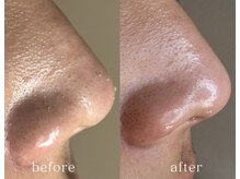 サロン モウ(mou。)