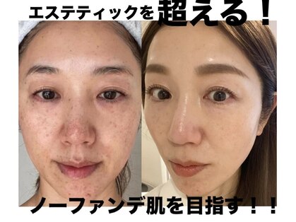 トータルエステティック ジョワイユ(JOYEUX)の写真