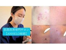 ANHELO姫路店