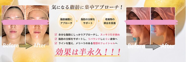 エステティックサロン フェアリー(ESTHETIC SALON FAIRLY)のサロンヘッダー