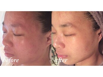 花銀クラブ(花銀Club)/フェイシャル 敏感肌の方もOK!