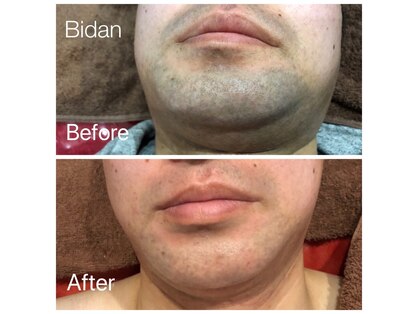 太田市の毛穴ケアが人気のエステサロン 口コミ人気ランキング ホットペッパービューティー