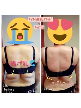 ビューティサロン キヨの部屋(beauty salon)/【美乳メソッド+キャビフル】