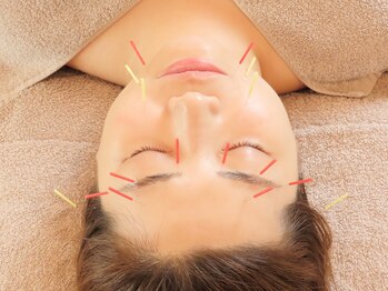 クランシュプール恵比寿鍼灸院/ハリウッド式美容鍼