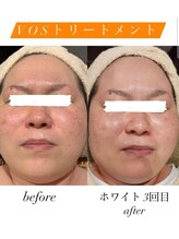 リリールア(Rere-Rua)/VOSサロンケア