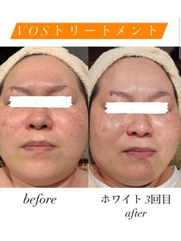 リリールア(Rere-Rua)/VOSサロンケア