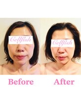 セルフィッシュ(Cellfish)/小顔矯正＆フェイシャル
