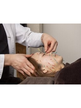 鍼灸施術を受けたい