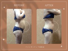 アバンダンティア 姫路店/月イチ施術でぜい肉撃退