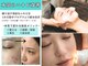ルナティアラ(LUNAティアラ)の写真