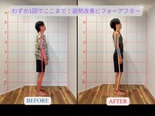 かんとま整骨院 中区鶴舞院/猫背矯正×EMS同時施術は当院へ