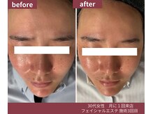 ウェルネス ステーション リンク(Wellness Station Link)/ビフォーアフター