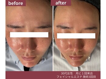 ウェルネス ステーション リンク(Wellness Station Link)/ビフォーアフター