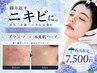 【6月限定】梅雨ニキビ対策 | プラズマ×韓国式ハーブピーリング ¥19,800→