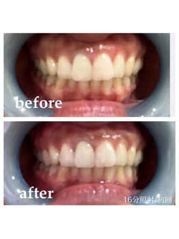 ホヌ ルアナ(Honu Luana)/お客様のビフォーアフター♪