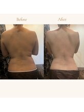 エードット 銀座(A.)/before　→　after