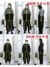 姫路なごみ整体院 なごみ鍼灸院/改善例（腰の痛み）